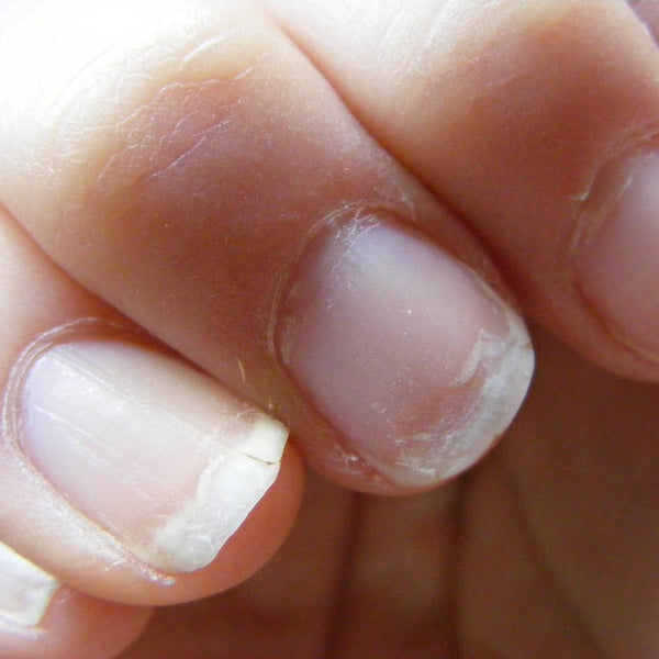 The Benefits of Gel Nails vs Acrylic Overlays  White Lotus Day Spa Medford