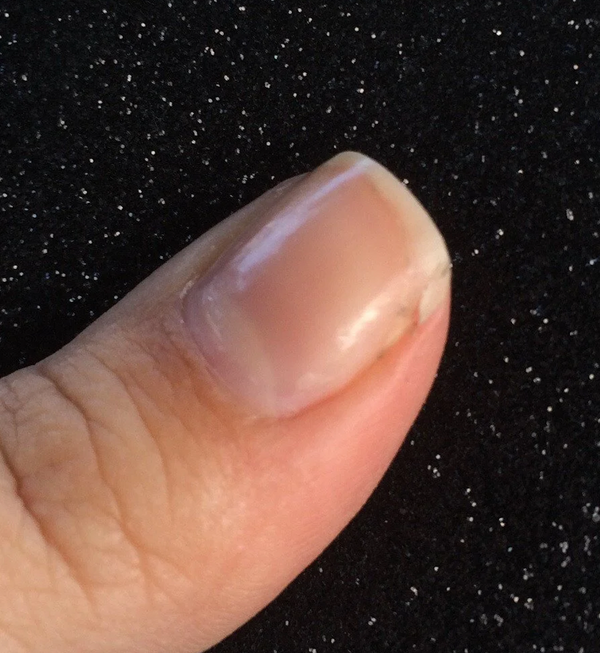 Why Nails Crack on the Sides and How to Prevent It