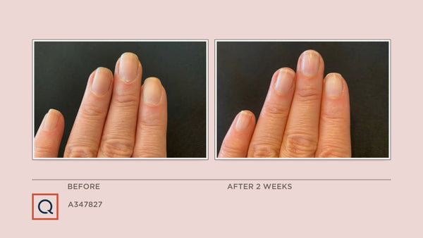 Nail Care - Nail Strengthener - Nail Defense Serum - Adesse New York